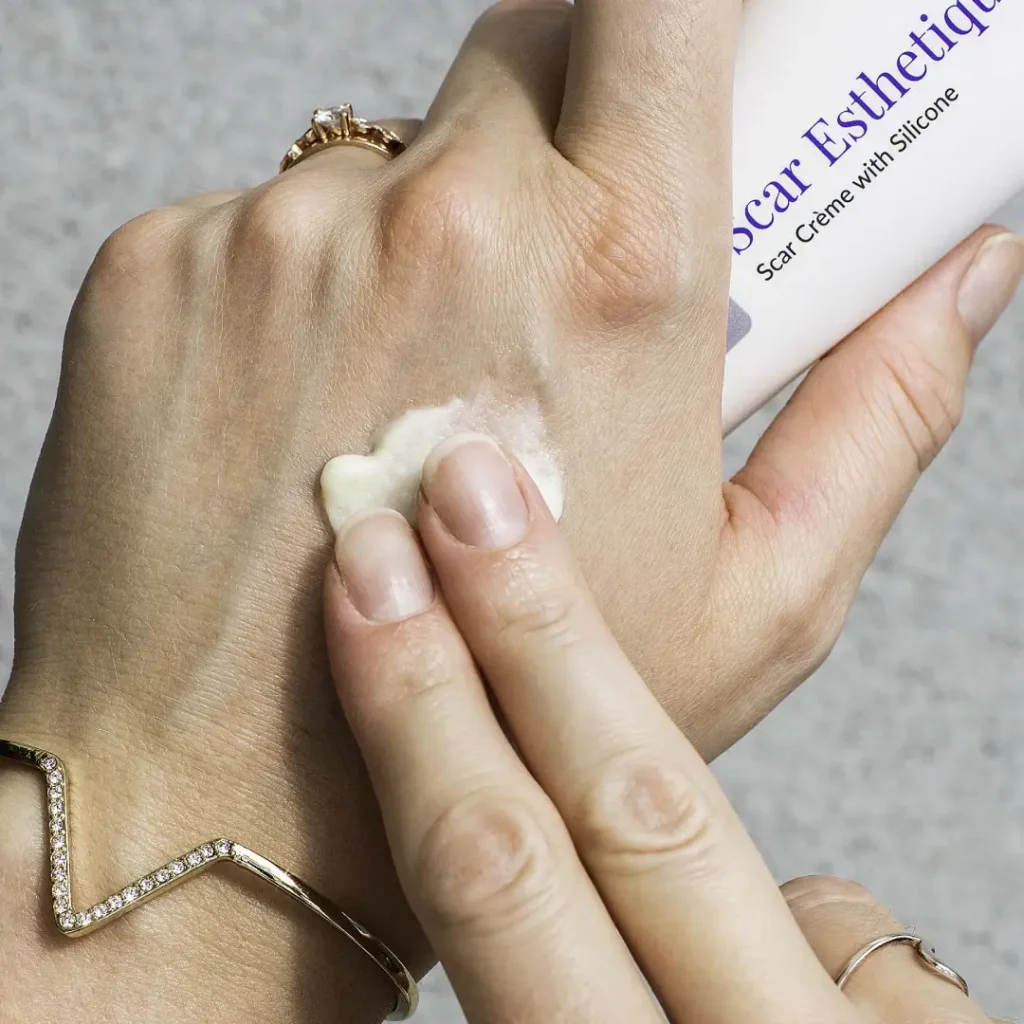 کرم اسکار استاتیک