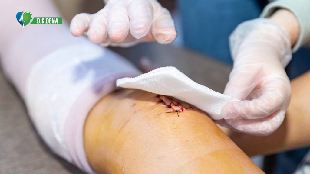 شست و شوی زخم